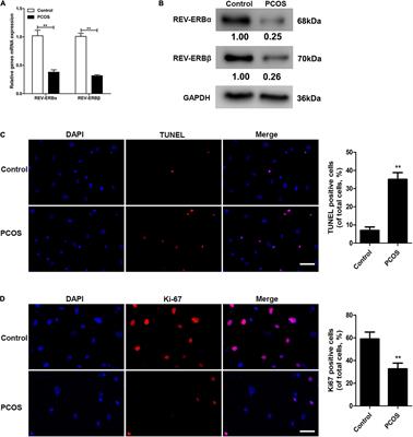 Circadian Clock Genes REV-ERBs Inhibits Granulosa Cells Apoptosis by Regulating Mitochondrial Biogenesis and Autophagy in Polycystic Ovary Syndrome